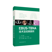 EBUS-TBNAg(jng)䰸