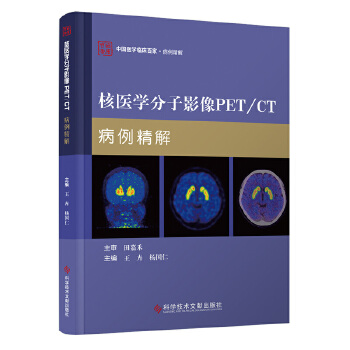  t(y)WӰPET/CT