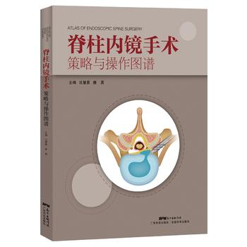  (ni)RgcDV