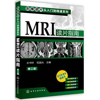 ӰxƬTͨϵ--MRIxƬָ(ڶ)(t(y)WӰNٰNRȫͣDƬጸԔM)